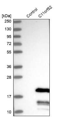 Western Blot: C11orf52 Antibody [NBP1-82060]