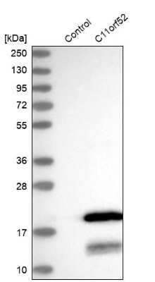 Western Blot: C11orf52 Antibody [NBP2-38409]