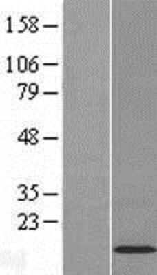 Western Blot: C11orf52 Overexpression Lysate [NBL1-08108]