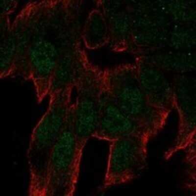 Immunocytochemistry/ Immunofluorescence: C11orf53 Antibody [NBP3-17472]