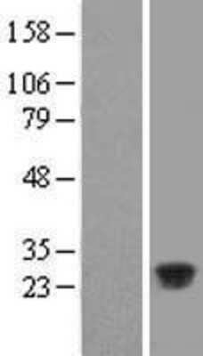 Western Blot: C11orf53 Overexpression Lysate [NBL1-08109]