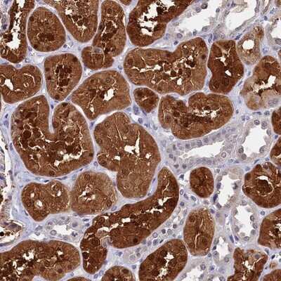 Immunohistochemistry-Paraffin: C11orf54 Antibody [NBP1-87193]