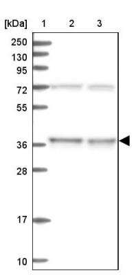 Western Blot: C11orf54 Antibody [NBP1-87194]