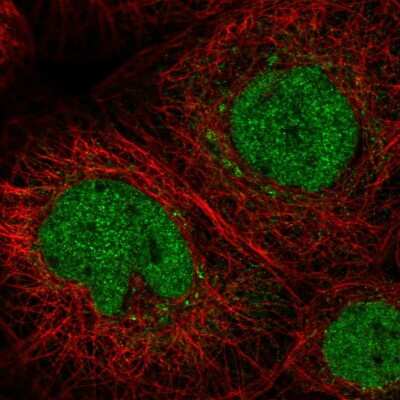 Immunocytochemistry/ Immunofluorescence: Junctional Cadherin Complex Regulator Antibody [NBP2-55674]