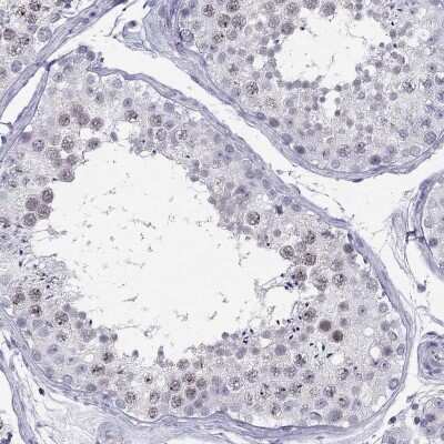 Immunohistochemistry: Junctional Cadherin Complex Regulator Antibody [NBP2-69051]