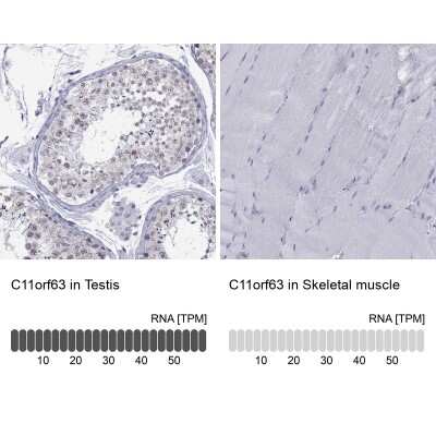 Immunohistochemistry-Paraffin: Junctional Cadherin Complex Regulator Antibody [NBP2-62719]