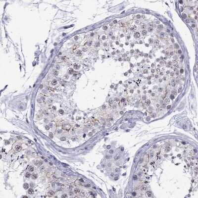 Immunohistochemistry-Paraffin: Junctional Cadherin Complex Regulator Antibody [NBP2-62719]