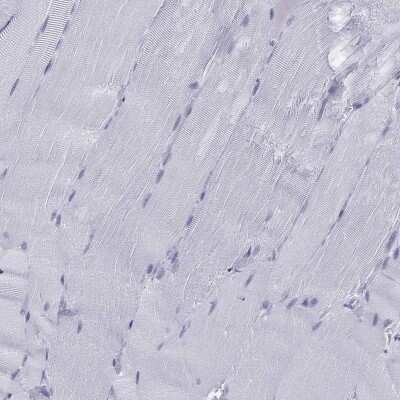 Immunohistochemistry-Paraffin: Junctional Cadherin Complex Regulator Antibody [NBP2-62719]