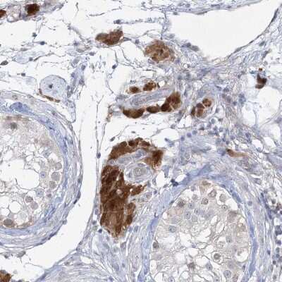 Immunohistochemistry-Paraffin: AAMDC Antibody [NBP2-31969]