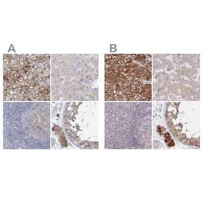 Immunohistochemistry-Paraffin: AAMDC Antibody [NBP2-31969]