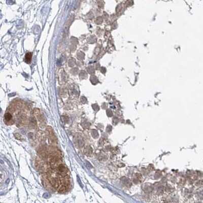 Immunohistochemistry-Paraffin: AAMDC Antibody [NBP2-31969]