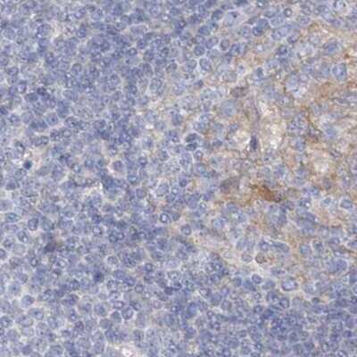 Immunohistochemistry-Paraffin: AAMDC Antibody [NBP2-31969]