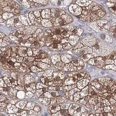 Immunohistochemistry-Paraffin: AAMDC Antibody [NBP2-31969]