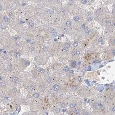 Immunohistochemistry-Paraffin: AAMDC Antibody [NBP2-31969]
