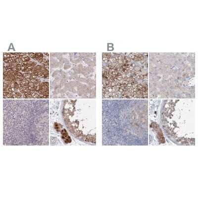 Immunohistochemistry-Paraffin: AAMDC Antibody [NBP2-34040]