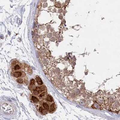 Immunohistochemistry-Paraffin: AAMDC Antibody [NBP2-34040]