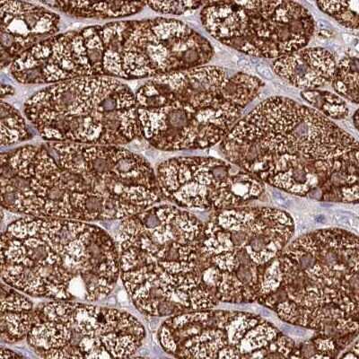 Immunohistochemistry-Paraffin: AAMDC Antibody [NBP2-34040]