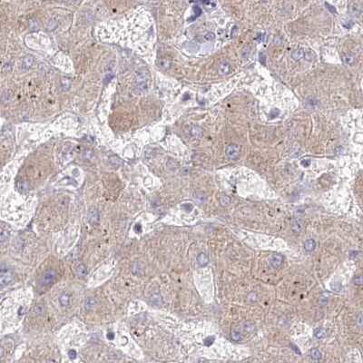 Immunohistochemistry-Paraffin: AAMDC Antibody [NBP2-34040]