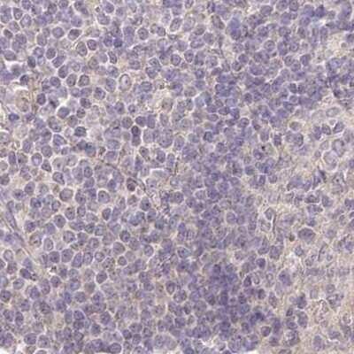 Immunohistochemistry-Paraffin: AAMDC Antibody [NBP2-34040]