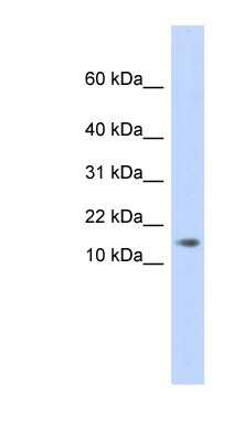 Western Blot: AAMDC Antibody [NBP1-56786]