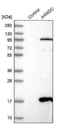 Western Blot: AAMDC Antibody [NBP2-34040]