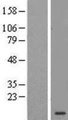 Western Blot: AAMDC Overexpression Lysate [NBL1-08115]