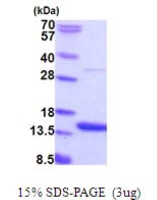 SDS-PAGE: Recombinant Human AAMDC His Protein [NBP2-51876]