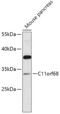 Western Blot: C11orf68 AntibodyAzide and BSA Free [NBP2-92303]