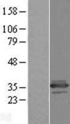 Western Blot: C11orf68 Overexpression Lysate [NBL1-08116]