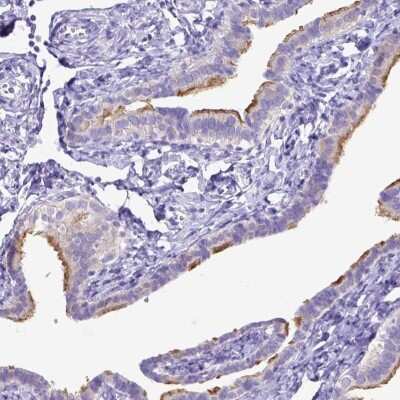 Immunohistochemistry-Paraffin: CFAP300 Antibody [NBP1-81213]