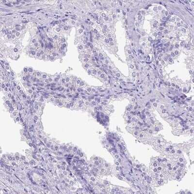 Immunohistochemistry-Paraffin: CFAP300 Antibody [NBP1-81213]