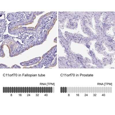 Immunohistochemistry-Paraffin: CFAP300 Antibody [NBP1-81213]
