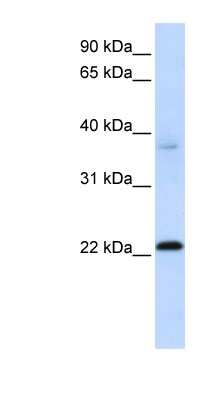 Western Blot: IFTAP Antibody [NBP1-56712]