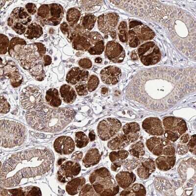 Immunohistochemistry-Paraffin: SMCO4 Antibody [NBP2-30385]