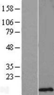 Western Blot: SMCO4 Overexpression Lysate [NBL1-08121]