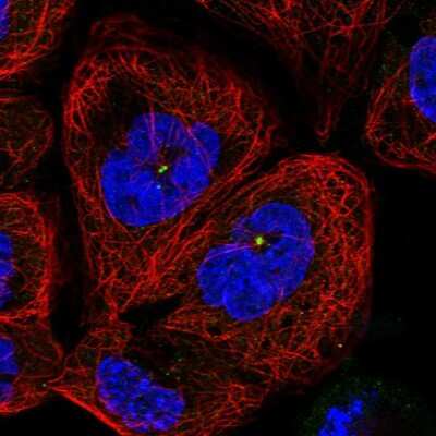 Immunocytochemistry/ Immunofluorescence: TOP6BL Antibody [NBP1-93944]