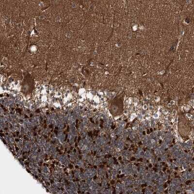 Immunohistochemistry: TOP6BL Antibody [NBP2-38433]