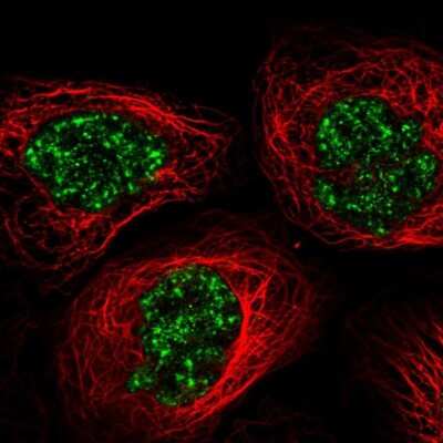 Immunocytochemistry/ Immunofluorescence: SPINDOC Antibody [NBP2-58309]