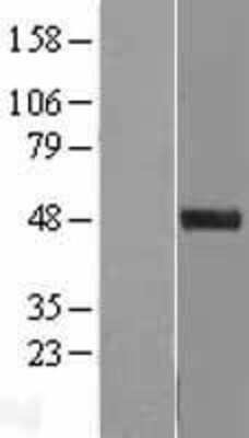 Western Blot: SPINDOC Overexpression Lysate [NBL1-12576]