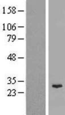 Western Blot: MAJIN Overexpression Lysate [NBP2-08550]