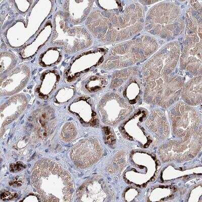 Immunohistochemistry-Paraffin: C11orf86 Antibody [NBP1-93940]