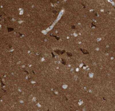 Immunohistochemistry-Paraffin: C11orf87 Antibody [NBP1-81296]