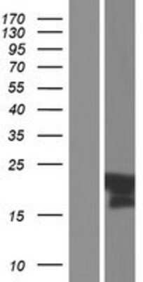 Western Blot: C11orf87 Overexpression Lysate [NBP2-04482]