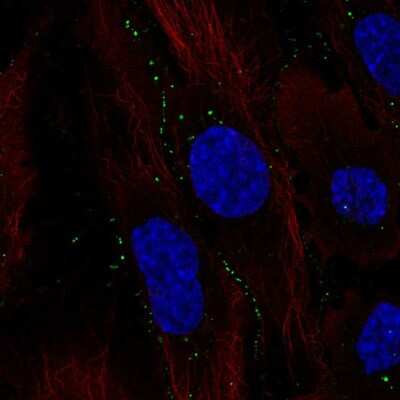 Immunocytochemistry/ Immunofluorescence: C11orf91 Antibody [NBP2-56091]