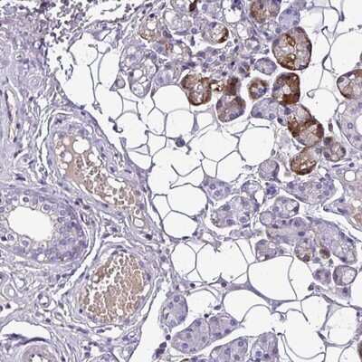 Immunohistochemistry-Paraffin: C11orf91 Antibody [NBP2-14706]