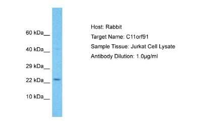 Western Blot: C11orf91 Antibody [NBP2-84535]