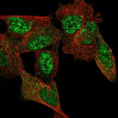 Immunocytochemistry/ Immunofluorescence: C11orf96 Antibody [NBP1-90866]