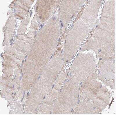 Immunohistochemistry-Paraffin: C11orf96 Antibody [NBP1-90866]