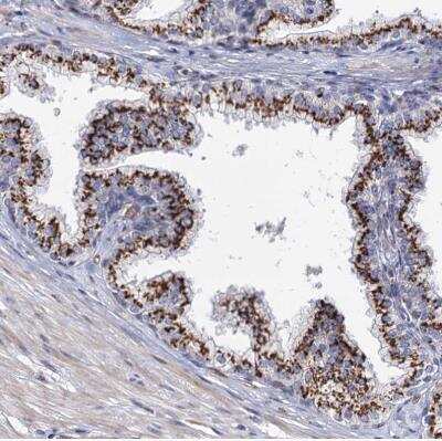 Immunohistochemistry-Paraffin: C11orf96 Antibody [NBP1-90866]