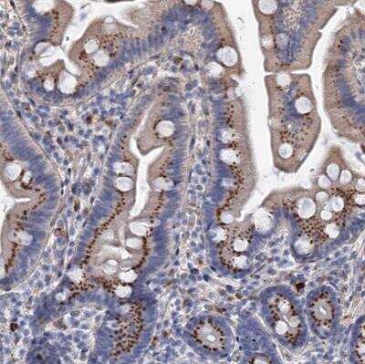 Immunohistochemistry-Paraffin: C11orf96 Antibody [NBP1-90866]